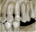 Endodontist in Wesley Chapel